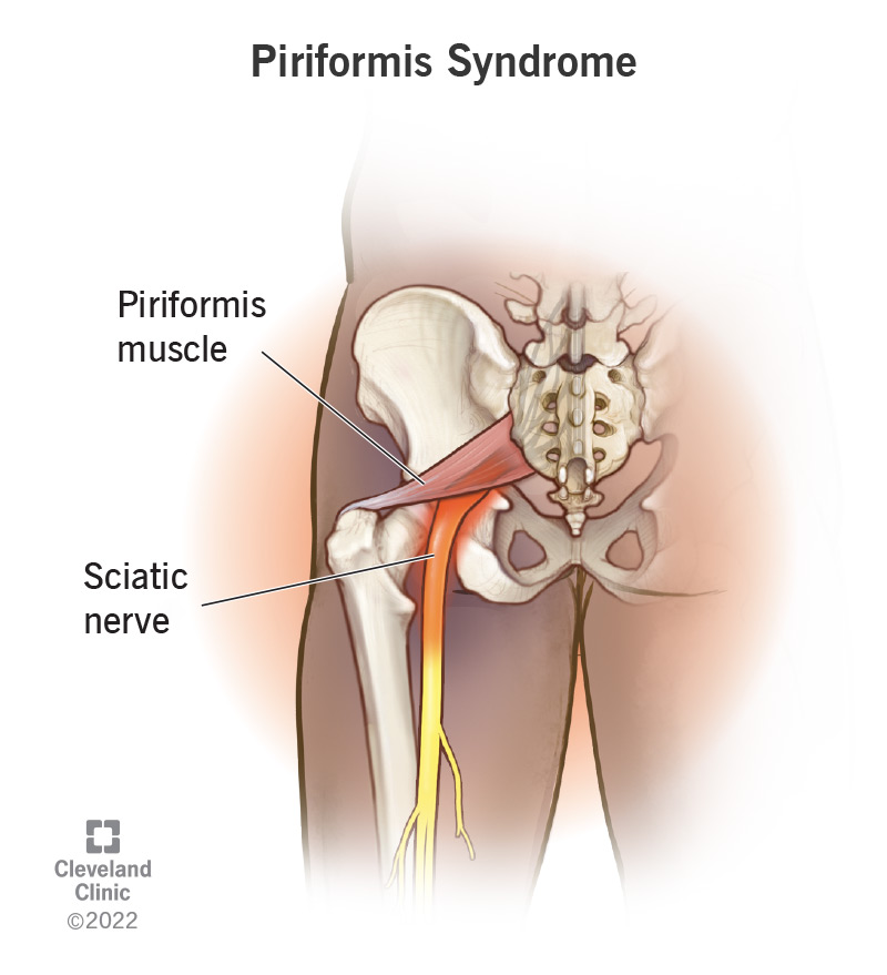 Sciatic nerve and piriformis muscle illustrated