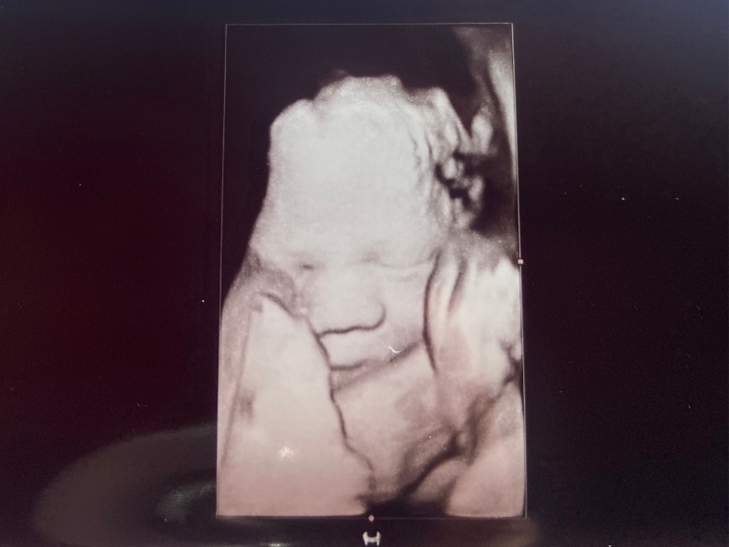 A Positive and Calm Birth Story (5th baby)